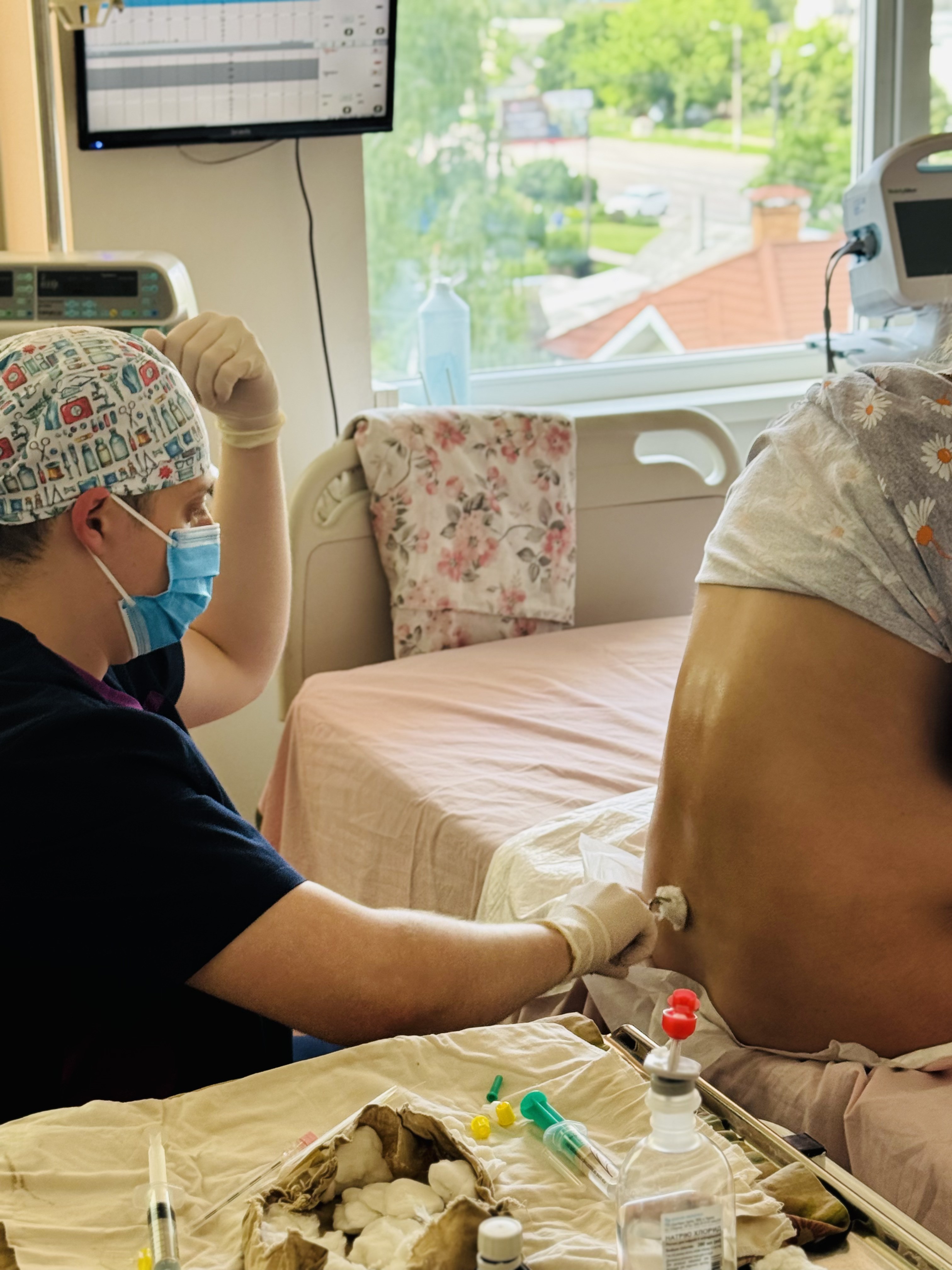 ЕПІДУРАЛЬНА АНЕСТЕЗІЯ ПІД ЧАС ПОЛОГІВ — що важливо знати?