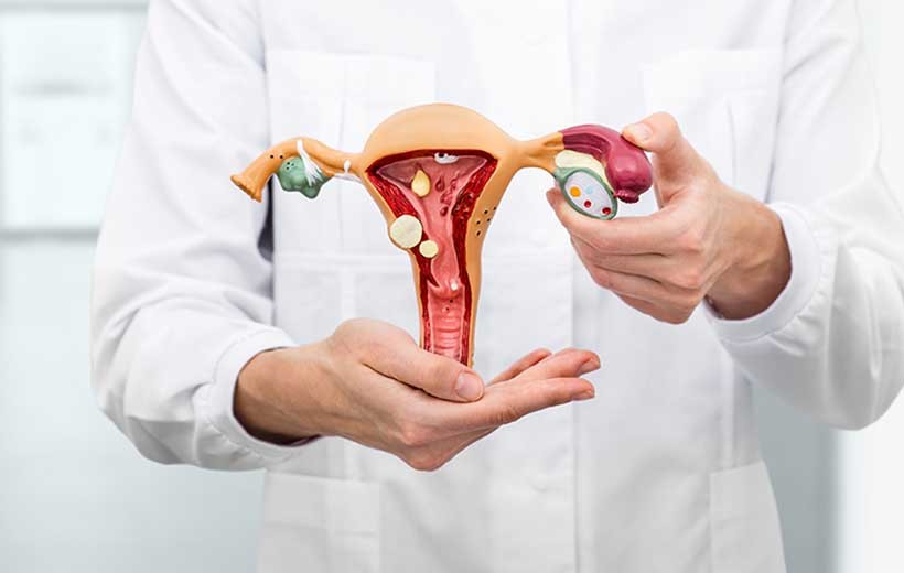 Як розпізнати перші симптоми поліпа матки? Як розпізнати перші симптоми поліпа матки?