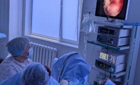 Гістероскопія при поліпі матки: що варто знати жінці?